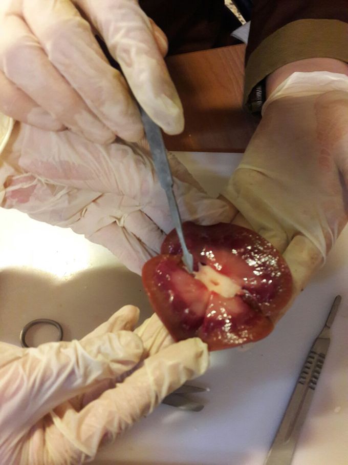 Kidney