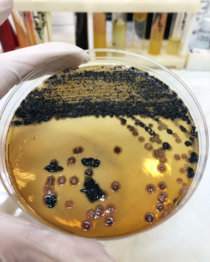 This is picture of fecal cultivation on Salmonella-Shigella agar. Black colonies belong to Citrobacter freundii.