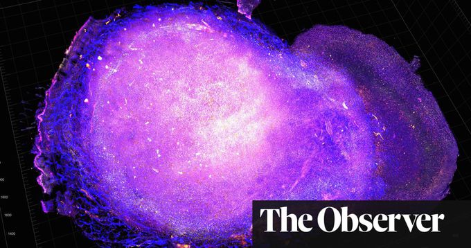 A cure for cancer: how to kill a killer
