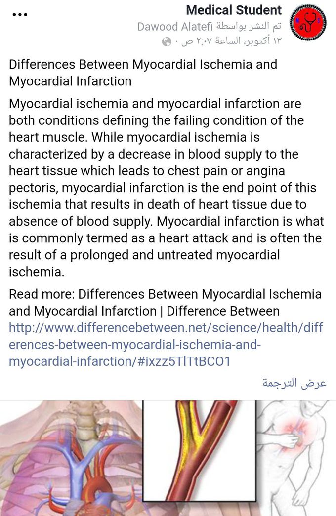 "MYOCADIAL ISCHEMIA" VS "MYOCARDIAL INFARCTION"