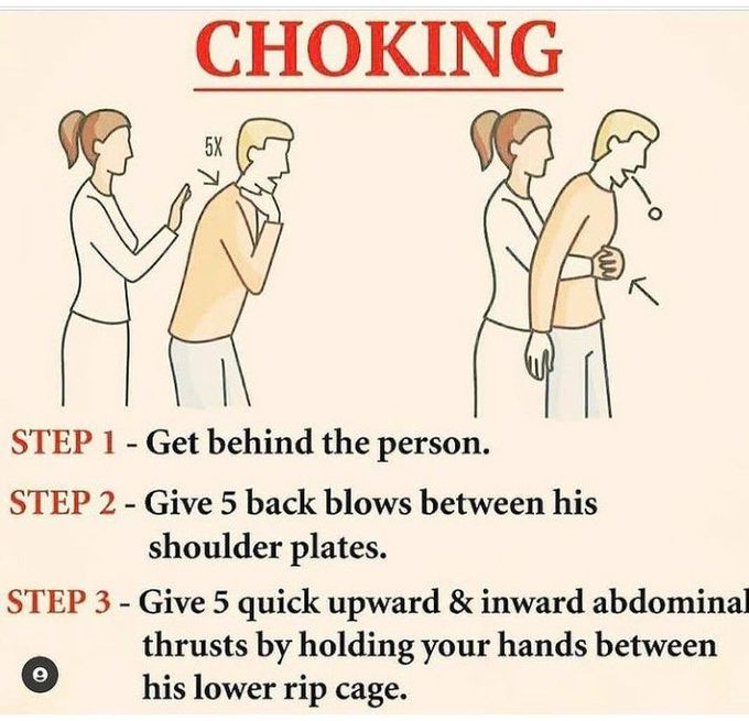 First aid of choking