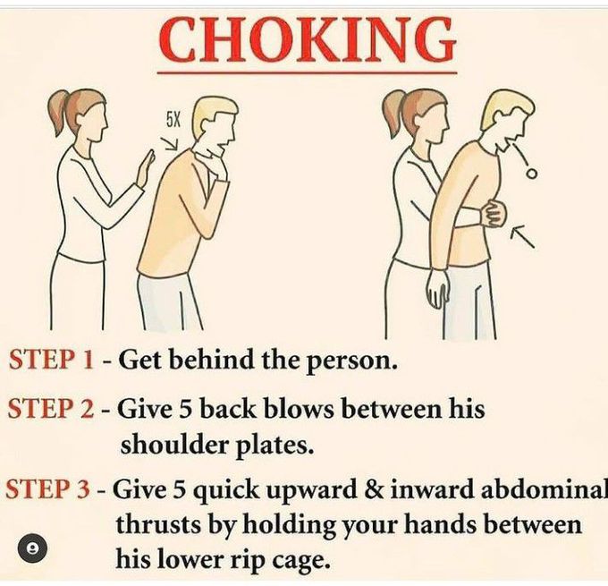 First Aid Of Choking Medizzy 