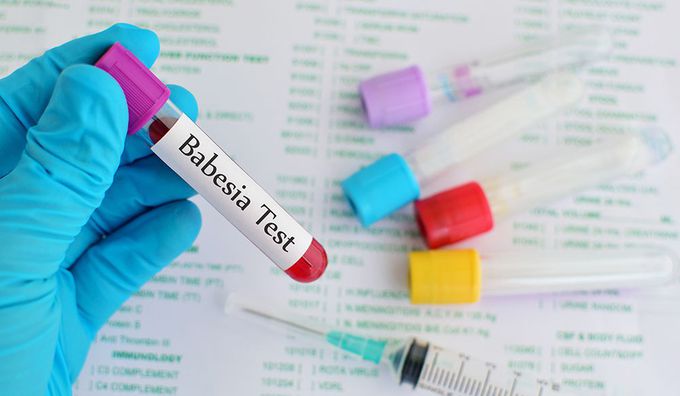 Treatment for Babesiosis
