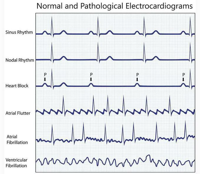 ECG💗💗