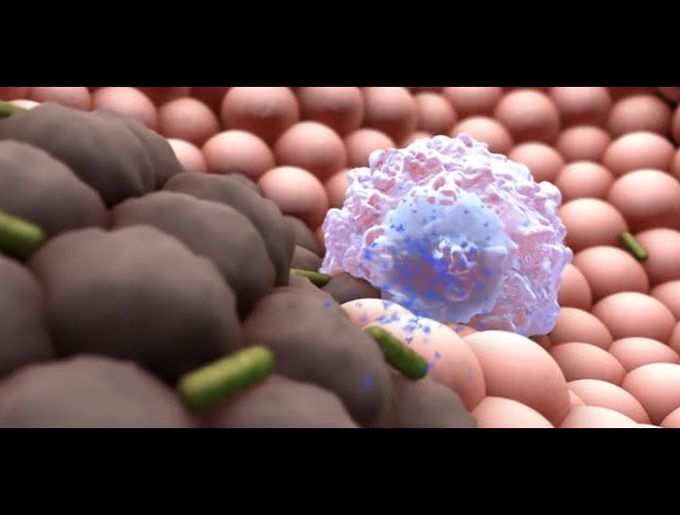 What Happens If You Get a Severe Case of COVID-19?