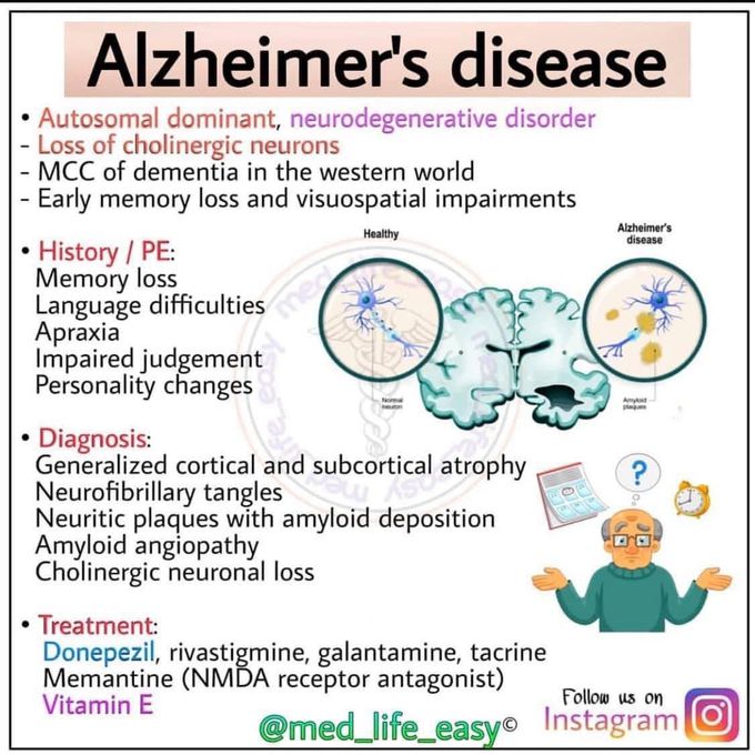 Alzehimer's disease