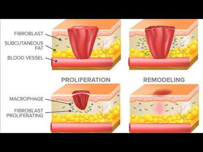 WOUND HEALING