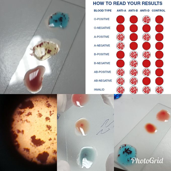 Blood type