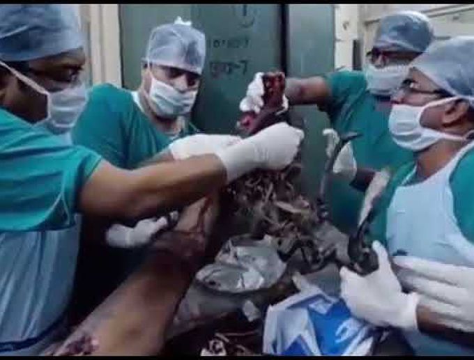 Amazing Medical Case Ep.1: Severe Leg Trauma!