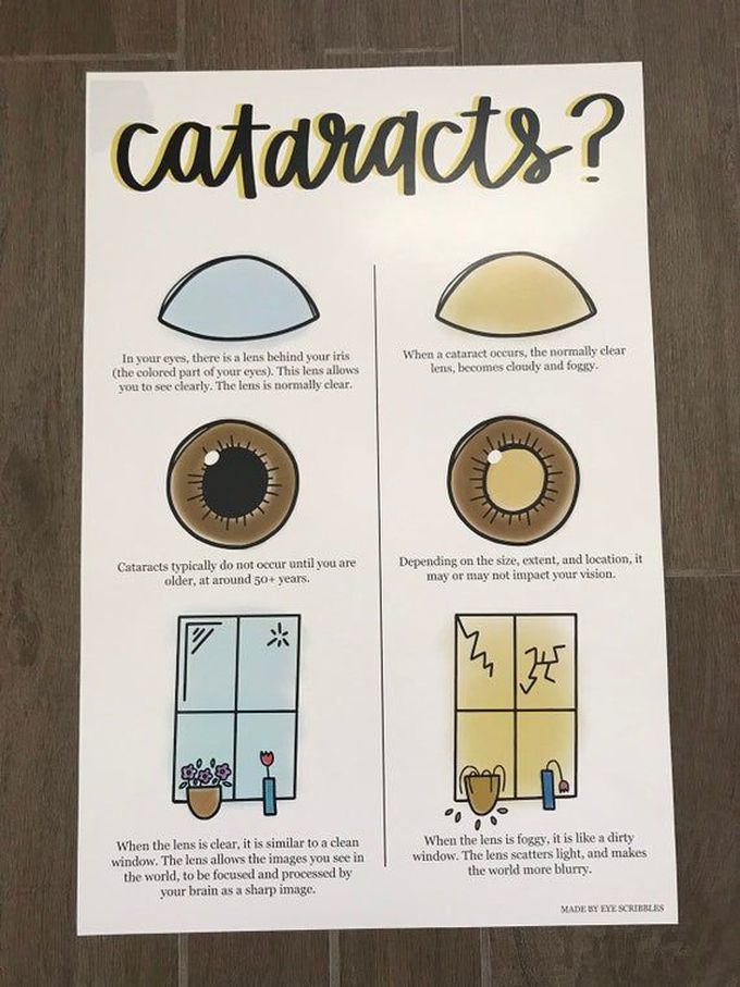 Cataracts