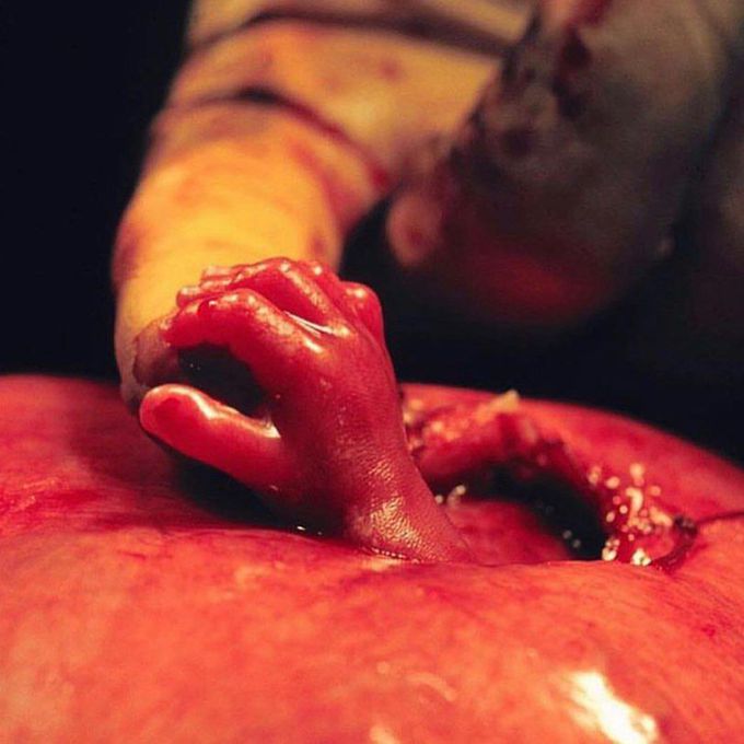 A “Finger for hope, touch for peace”. 