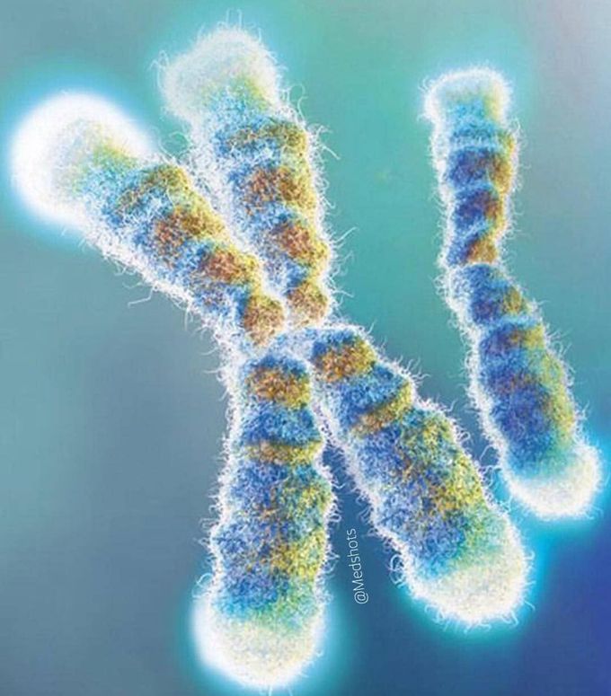 Here is a really interesting picture showing a chromosome in a close up view! 