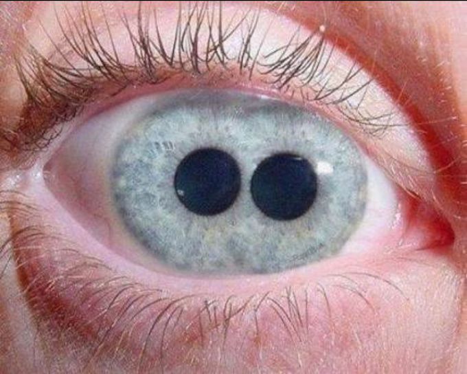 POLICORIA: Extreme rare conditions