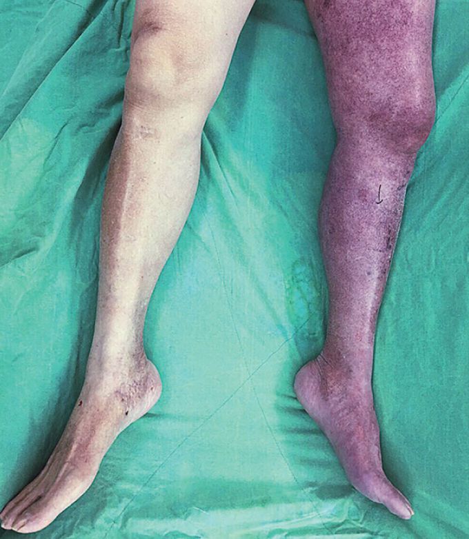 What is your diagnosis???