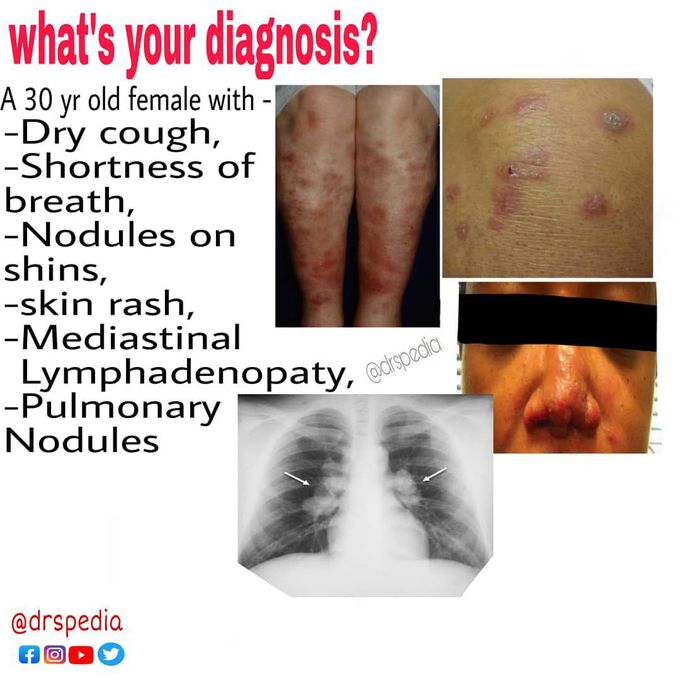 Diagnose the disorder ?