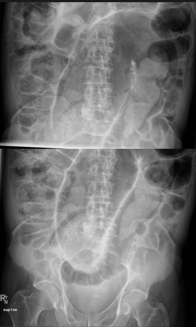 What is tge diagnosis???