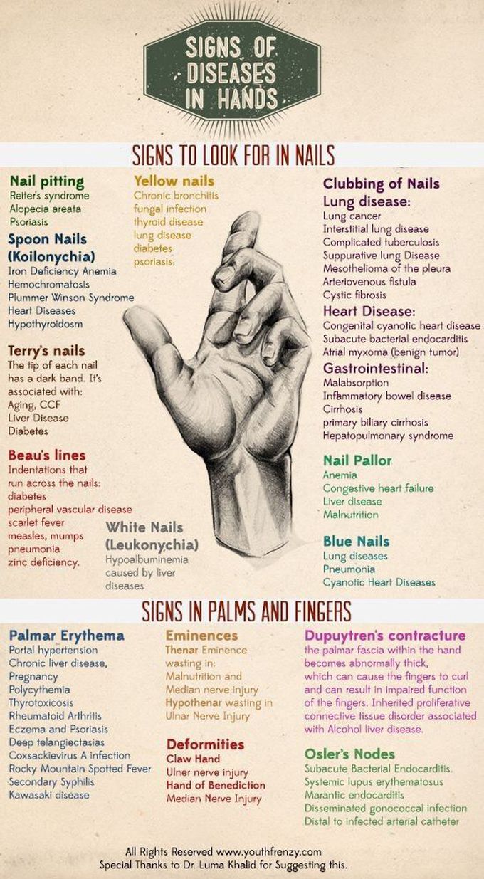 Mind ur nails