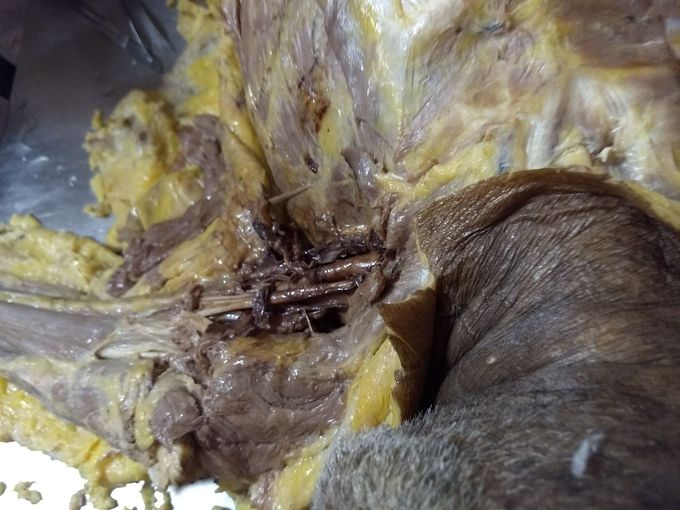 Biceps bracii and adjacent arteries and  veins.