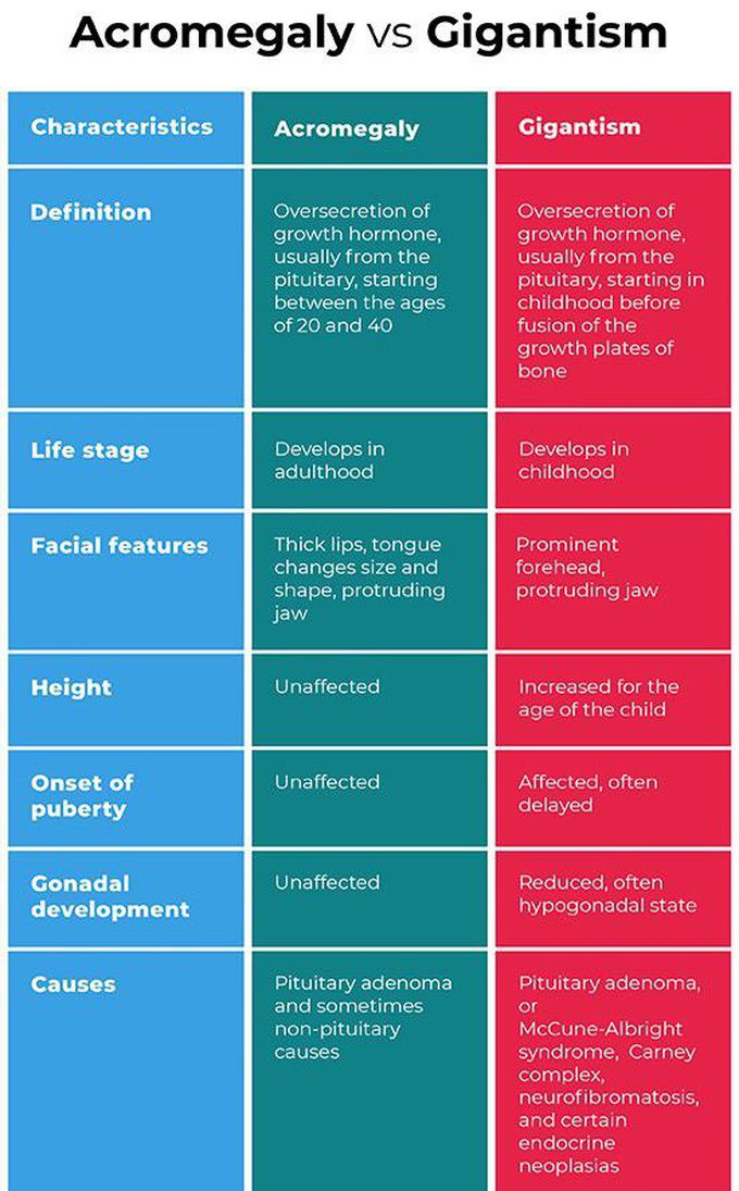 pituitary gigantism vs acromegaly