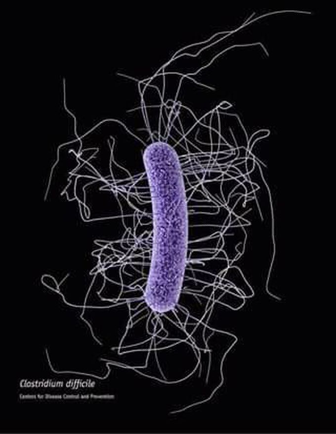 Clostridium tetanus