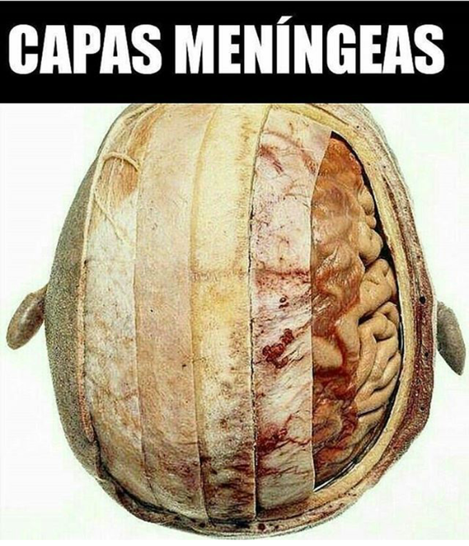 Neurology