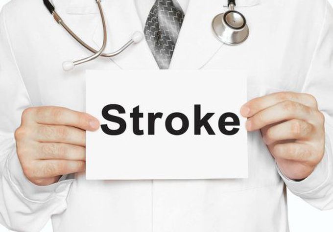 Stroke Risk Increases for 3 Months, Not 1, After MI