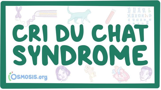 Cri du chat syndrome - causes, symptoms, diagnosis, treatment, pathology