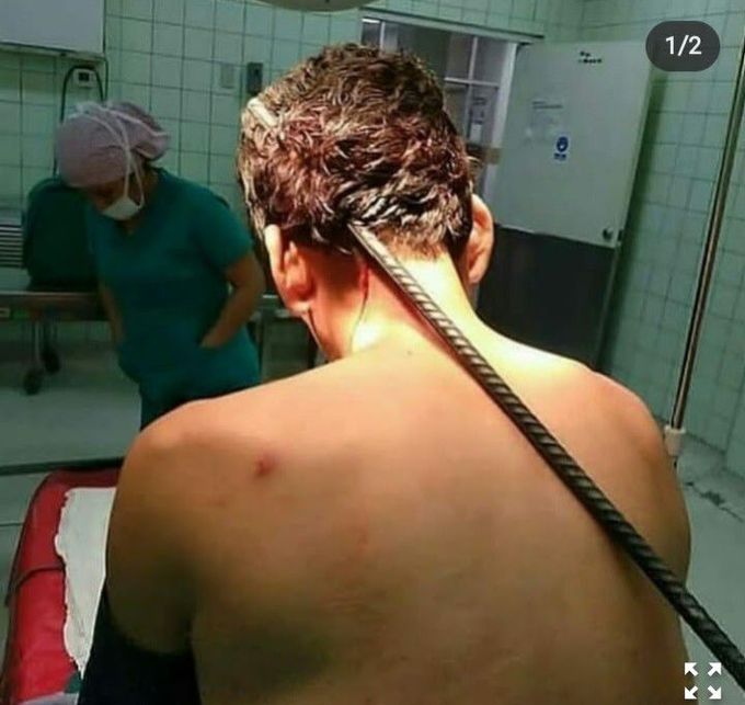 neurosurgery