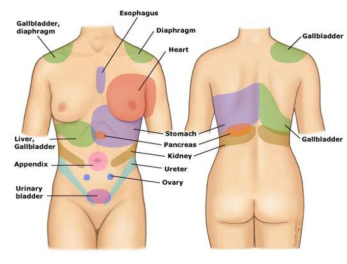 Referred pain