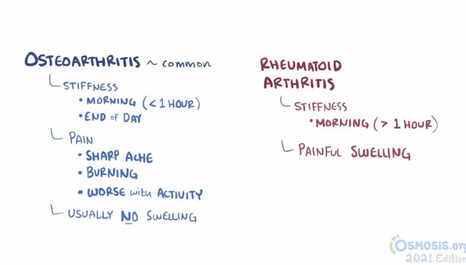 Osteoarthritis Vs Rheumatoid arthritis Symptoms