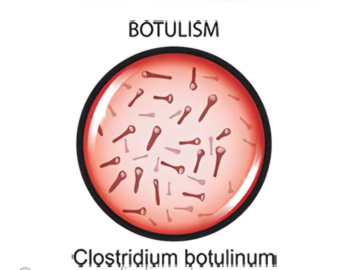 Cause of Botulism