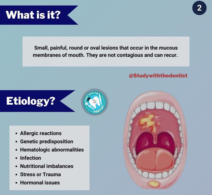 Aphthous Ulcers I