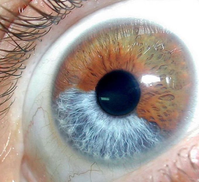 What is your diagnosis??