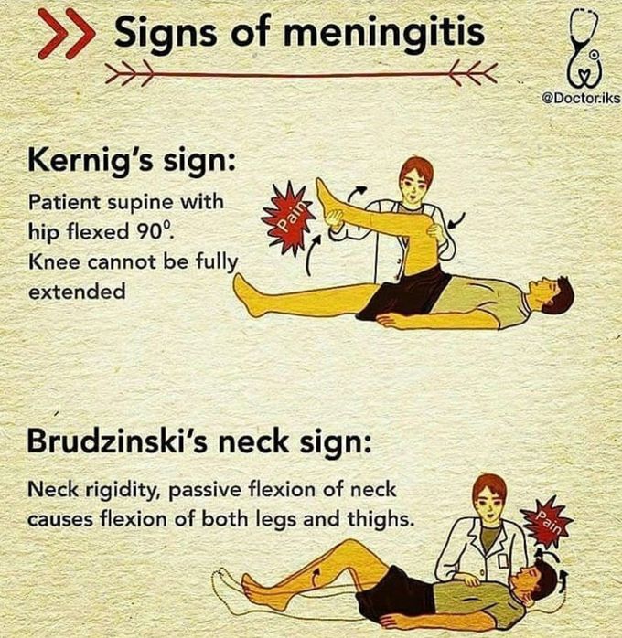 Signs of meningitis