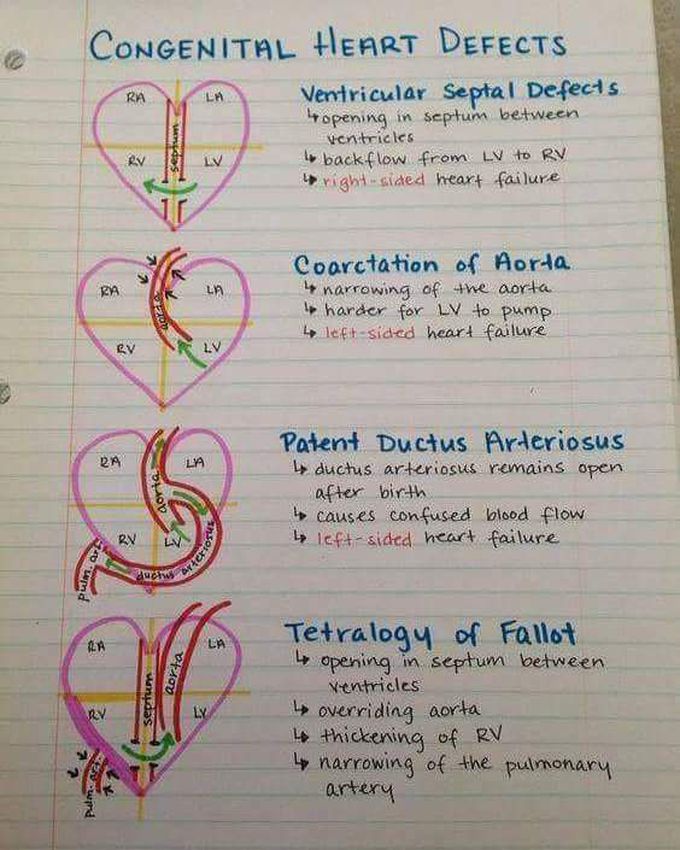 Heart defects....#cardiology