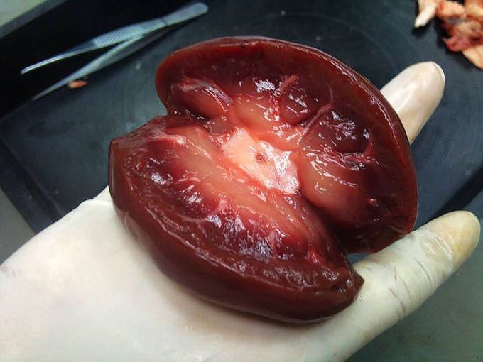 Kidney dissection!