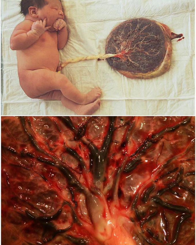 The human placenta, where life begins