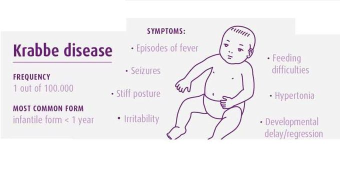 Treatment of Krabbe's disease