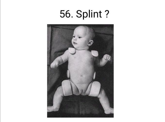Describe the splint?