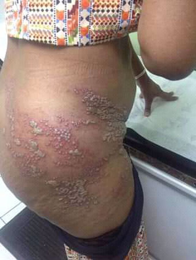 Diagnosis and treatment please
