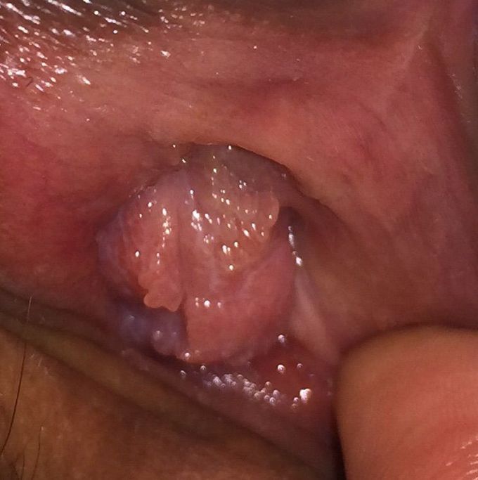 Diagnosis?