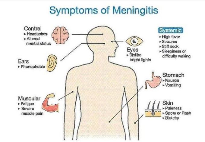 Symptoms of meningitis