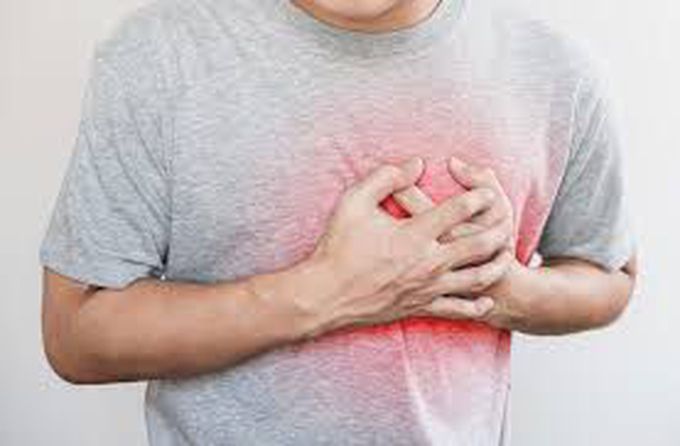 Myocardial infarction