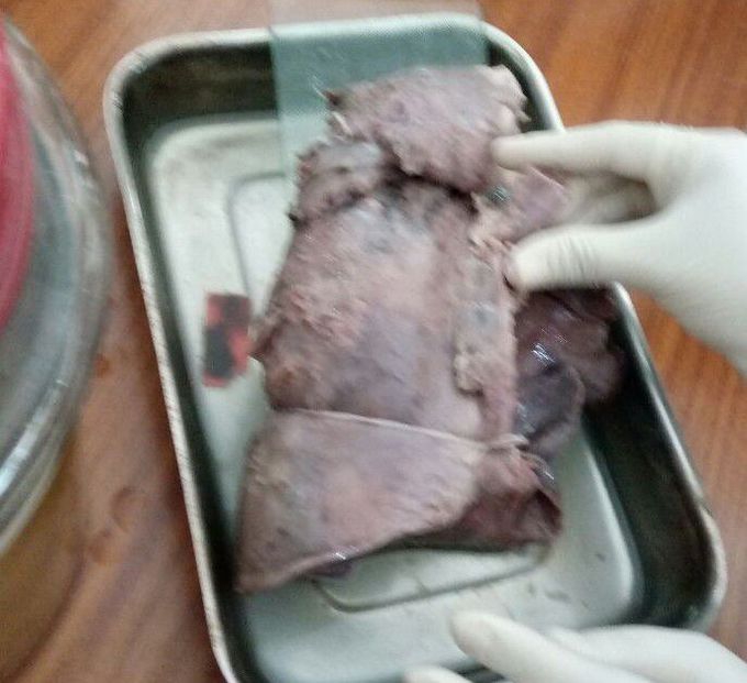 Anatomy