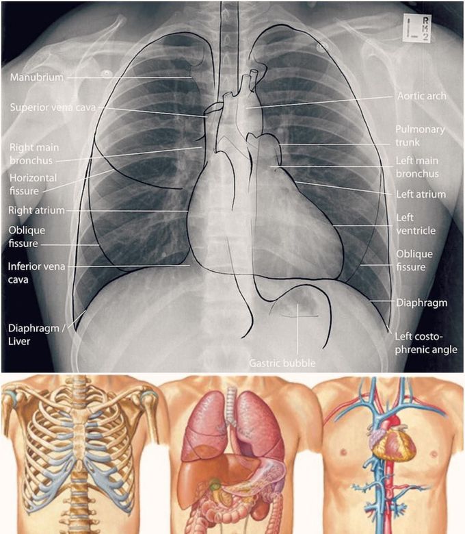 Amazing Shot Of The Chest Anatomy Labeled On X Ray