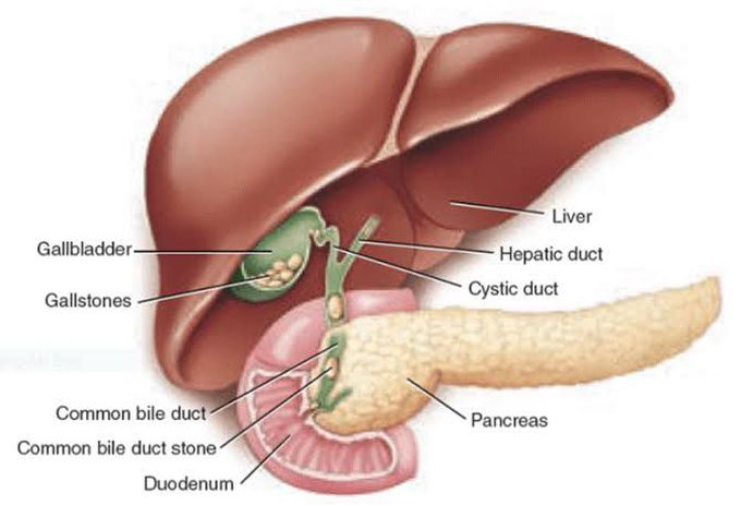 Symptoms of choledocholithiasis