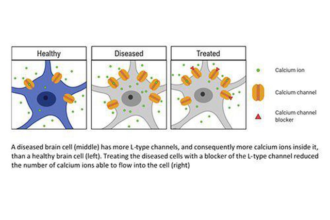 Calcium channel blockers may be effective in treating Alzheimer's memory loss - ScienceBlog.com