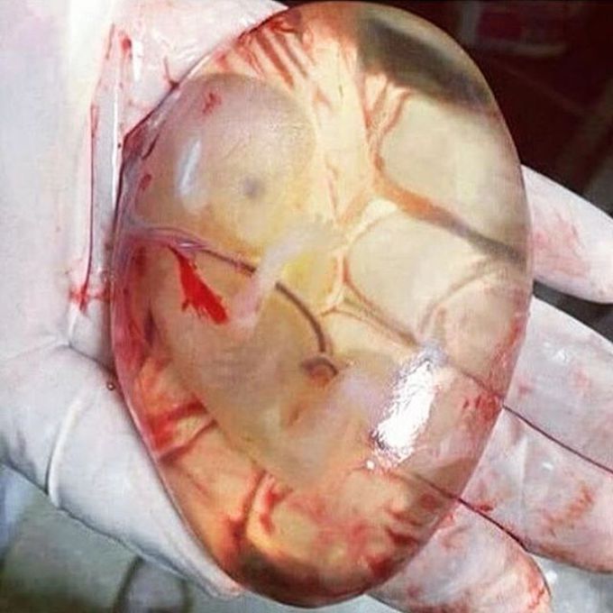 The embryo