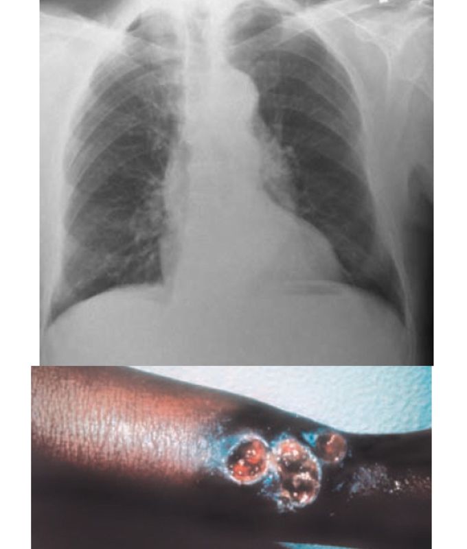 Case2