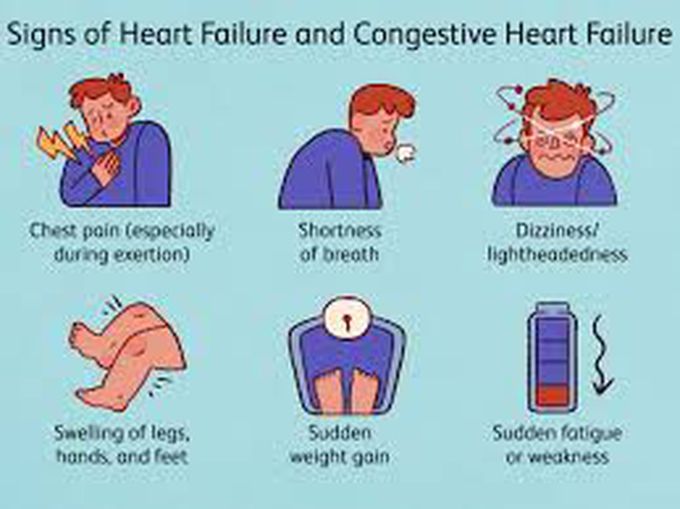 Symptoms of congestive heart failure